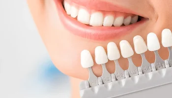 Useful Information about Veneers that You Should Know