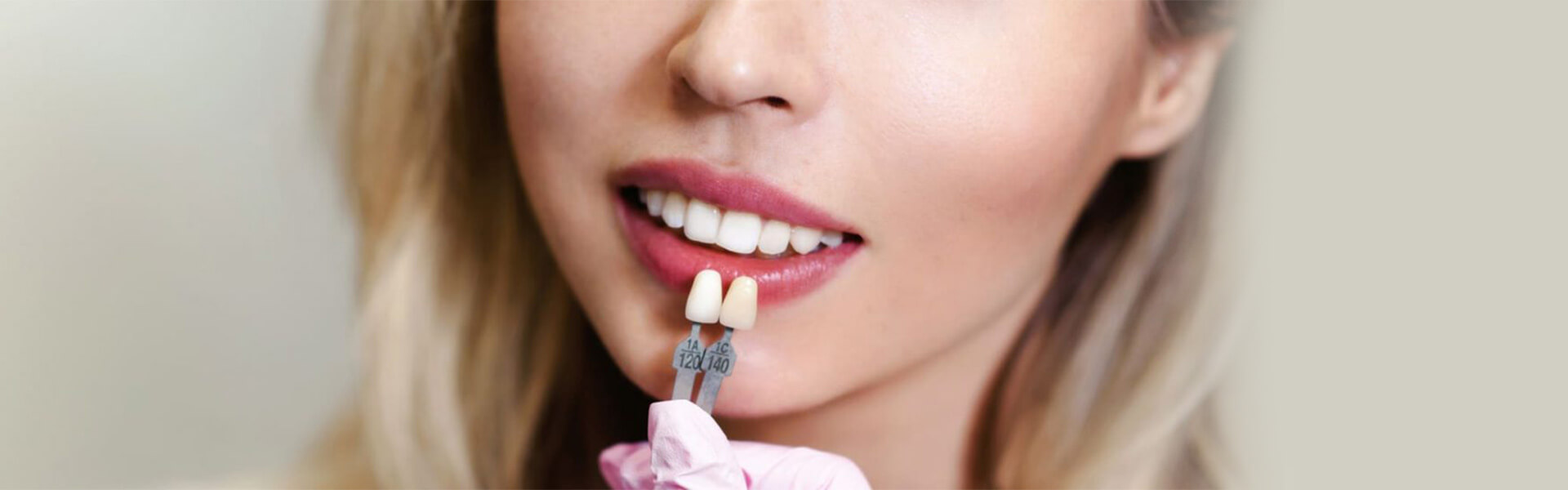 Useful Information about Veneers that You Should Know
