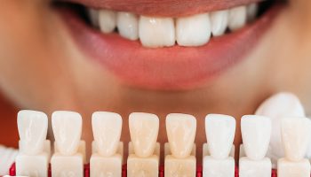 Useful Information about Veneers that You Should Know