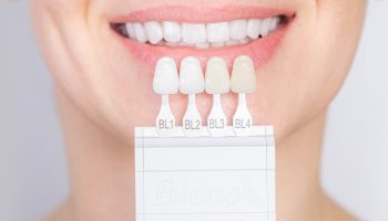 Dental Veneers FAQS