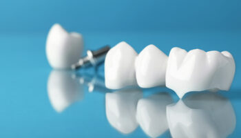 The Dental Crown Procedure: A Comprehensive Guide