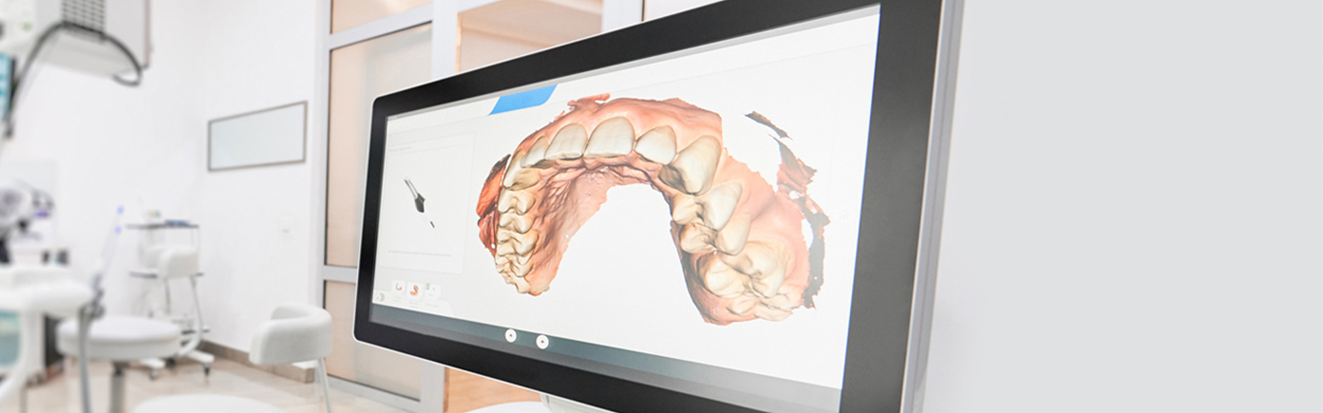 The Importance of Regular Oral Cancer Screenings: What You Need to Know